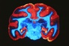 Brain scan image