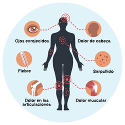 Imagen de los sintomas de Zika